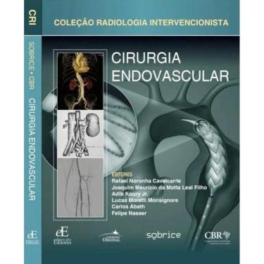 Imagem de Cirurgia Endovascular  Colecao Radiologia Intervencionista