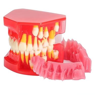 Imagem de faruijie Modelo De Desenvolvimento Da Erupção Dentária - Alternância Pressão Constante Na Dentição Decídua Para Mostrar Claramente O Processo Mudança Permanente
