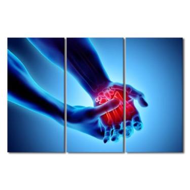 Imagem de TUMOVO Arte de parede para sala de estar tamanho grande anatomia humana ortopédica escritório médico decoração de parede impressões em tela esqueleto raio X arte moderna 3D para quarto emoldurado