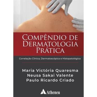 Imagem de Compendio De Dermatologia Pratica