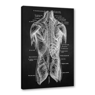 Imagem de Fundo preto anatomia humana arte médica impressões em tela imagens esqueleto músculo pôster vintage educação pintura arte decoração de parede (SKU2,40.6x61.0 cm = (40x60cm), emoldurado (tela embalada