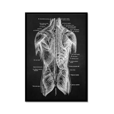 Imagem de Fundo preto anatomia humana arte médica impressões imagens esqueleto músculo pôster vintage educação pintura arte decoração de parede (SKU2,20.3x30.5 cm = (20x30cm), moldura de metal preto)