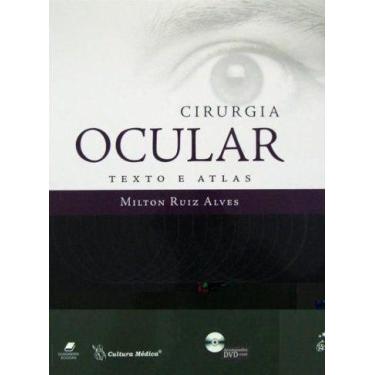 Imagem de Livro - Cirurgia Ocular