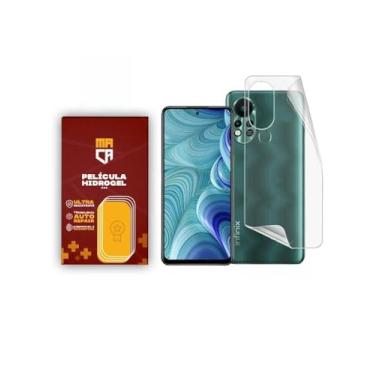 Imagem de Película Hidrogel Infinix Frente e Verso Fosca Todos Modelos