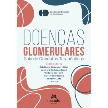 Imagem de Livro - Doenças glomerulares