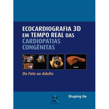 Imagem de Livro - Ecocardiografia 3D em Tempo Real das Cardiopatias Congênitas