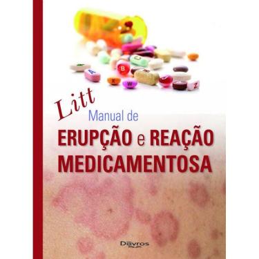Imagem de Litt Manual De Erupcao E Reacao Medicamentosa