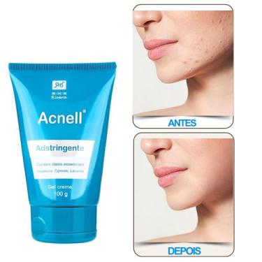 Imagem de Gel creme para acne com Óleos Essenciais Acnell 100gr - RHR