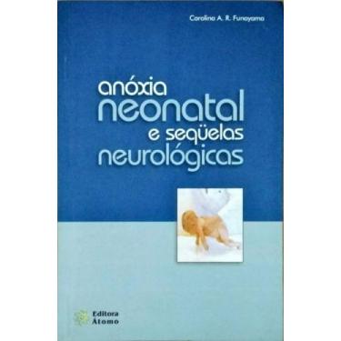 Imagem de Anoxia neonatal e sequelas neurologicas - ATOMO E ALINEA, 3