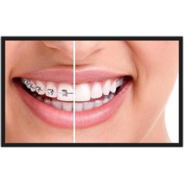 Imagem de Quadro Decorativo Consultórios Odontologia Dentista Dentes Sorriso Est