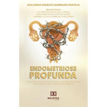 Imagem de Endometriose Profunda: a importância da ultrassonografia e dos biomarcadores imunológicos para o diagnóstico precoce