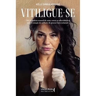 Imagem de Vitiligue-se: um verdadeiro manual de como vencer as adversidades e tocar o coração de milhares de pessoas (sem reclamar).