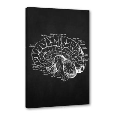 Imagem de Fundo preto anatomia humana arte médica impressões em tela imagens esqueleto músculo pôster vintage educação pintura arte decoração de parede (SKU9,30.5x40.6 cm = (30x40cm), emoldurado (tela embalada