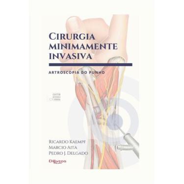 Imagem de Cirurgia minimamente invasiva artroscopia do punho - Di Livros Editora