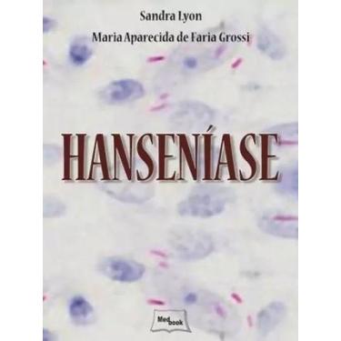 Imagem de Livro - Hanseníase