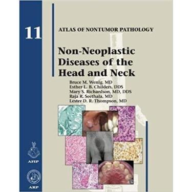 Imagem de Non-neoplastic Diseases Of The Head And Neck