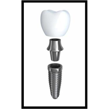 Imagem de Quadro Decorativo Dentista Implantes Dentes Odontologia Consultórios S