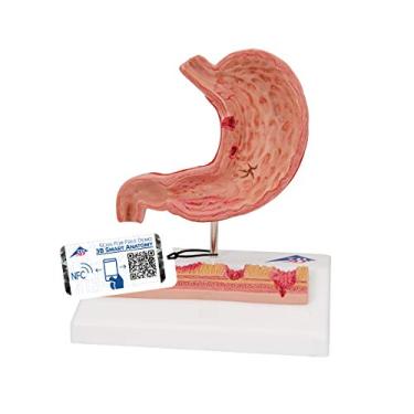 Imagem de 3B Scientific K17 Stomach with Ulcers Model, 14cm x 9.9cm x 17cm