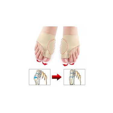 Imagem de Par de corretor de joanete para ambos os pés - Lightbek Official Store