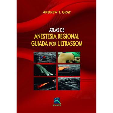Imagem de Atlas De Anestesia Regional Guiada Por Ultrason