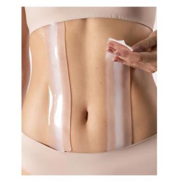 Imagem de Fita Silicone Canaleta Triangular Colante Lipo Hd Siliskin 2