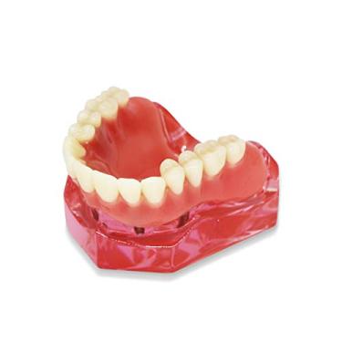 Imagem de D-DT Modelo de Dentes Dentários, Maxilar Mandibular Transparente Modelo de Dentes de Implante Dentário Modelo de Dente Padrão de Dentista Removível Patológica Modelo de Ensino (Maxilar)