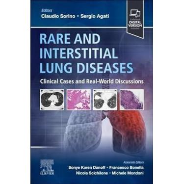 Imagem de Rare and interstitial lung diseases - ELSEVIER (IMPORT) 2024