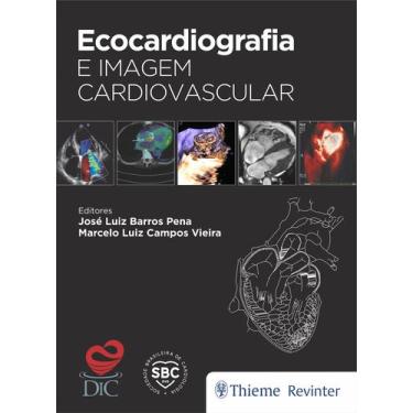 Imagem de Livro - Ecocardiografia e Imagem Cardiovascular