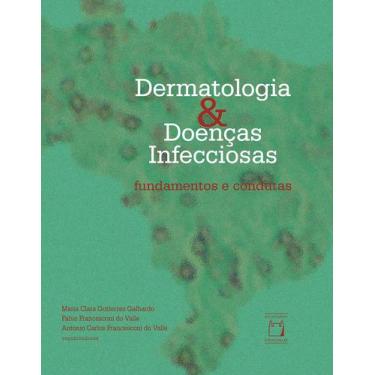 Imagem de Livro - Dermatologia E Doenças Infecciosas