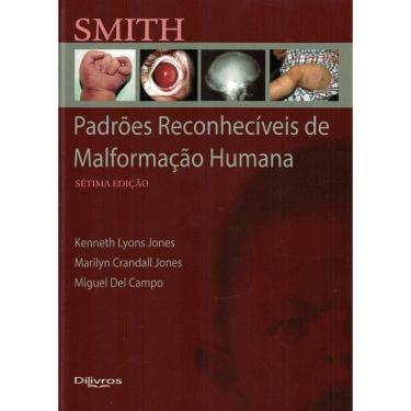 Imagem de Smith Padroes Reconheciveis De Malformacao Humana