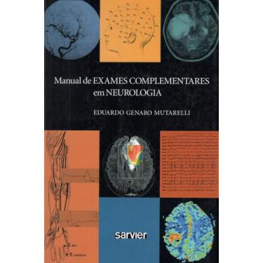 Imagem de Livro - Manual De Exames Complementares Em Neurologia