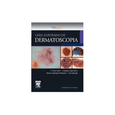 Imagem de Livro - GUIA ILUSTRADO DE DERMATOSCOPIA - elsevier