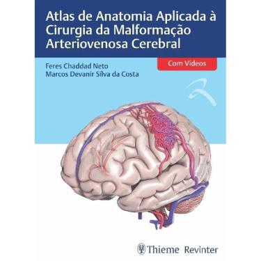 Imagem de Atlas De Anatomia Aplicada Cirurgia Da Malformacao Arteriovenosa Cerebral