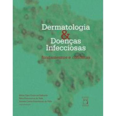 Imagem de Dermatologia e doenças infecciosas