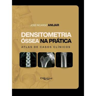 Imagem de Densitometria Ossea Na Pratica