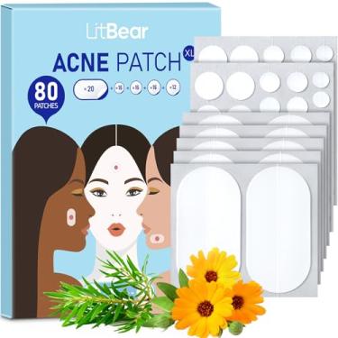 Imagem de Acne Pimple Patches, 5 Sizes 80 Patches for Large Zit Breakouts, LitBear Acne Patches for Face, Chin or Body, Acne Spot Treatment with Tea Tree & Calendula Oil, Hydrocolloid Bandages for Acne Skin
