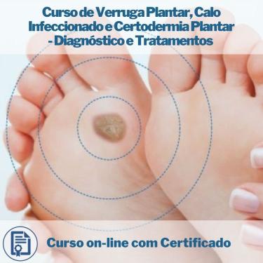 Imagem de Curso on-line de Verruga Plantar, Calo Infeccionado e Certodermia Plantar - Diagnóstico e Tratamentos com Certificado