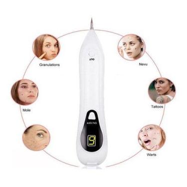 Imagem de Caneta Despigmentador Jato De Plasma Com 5 Agulhas - alfashop