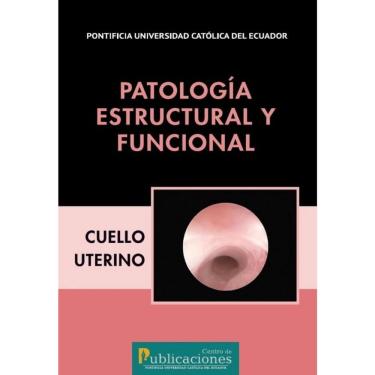 Imagem de Patología estructural y funcional. Cuello uterino - Espanhol