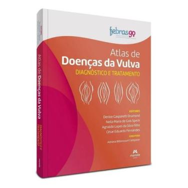 Imagem de Atlas de Doenças da Vulva - Diagnóstico e Tratamento - 01Ed/22 - MANOL