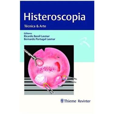 Imagem de Histeroscopia Tecnica E Arte