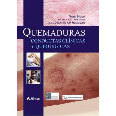 Imagem de Livro - Quemaduras - Conductas clinicas y quirurgicas
