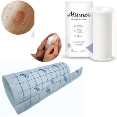 Imagem de Kit Curativo Filme 10cm X 1 Metro + Fita Microporosa 10x10cm