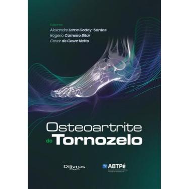 Imagem de Osteoartrite Do Tornozelo, Autor: Godoy-Santos, Alexandre Leme/ Bitar,