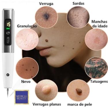 Imagem de Jato De Plasma Medical Beauty 15 Niveis Profissional - Top