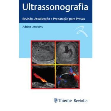 Imagem de Ultrassonografia