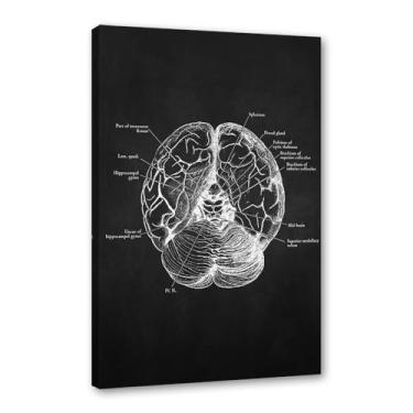 Imagem de Fundo preto anatomia humana arte médica impressões em tela imagens esqueleto músculo pôster vintage educação pintura arte decoração de parede (SKU7,30.5x40.6 cm = (30x40cm), emoldurado (tela embalada