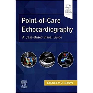 Imagem de Point-of-care Echocardiography