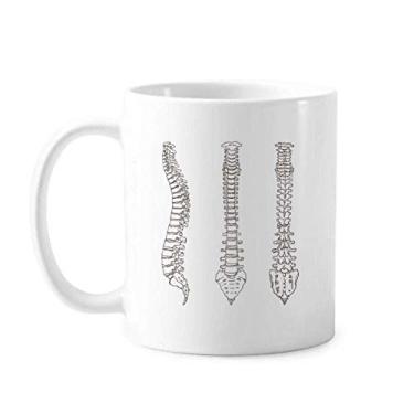 Imagem de Esqueleto Esboço Coluna Caneca Humana Cerâmica Café Porcelana Utensílios de Mesa