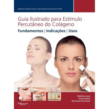 Imagem de Guia Ilustrado Para Estimulo Percutaneo Do Colageneo